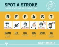 What is fast for brain stroke?