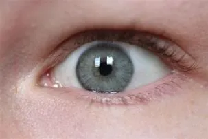 What rarity is grey eyes?