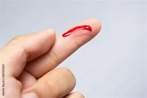 Why is my blood black when i cut my finger?