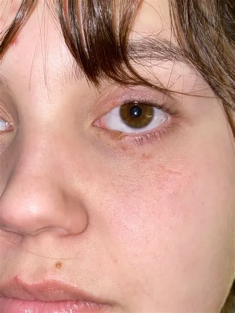 How did sub-zero get his eye scar