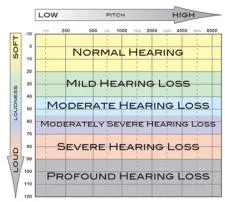 What is 2000 8000 hz hearing loss?